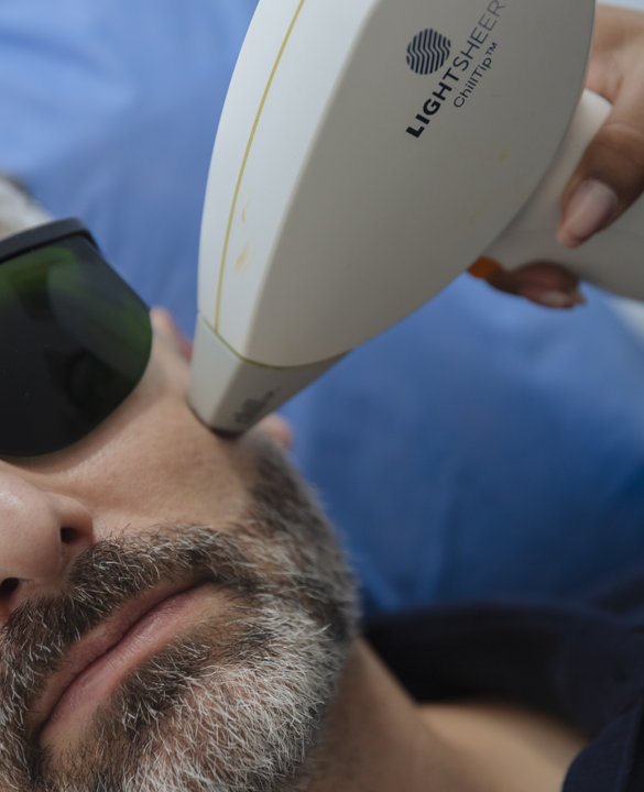 Diode Laser Hair Removal