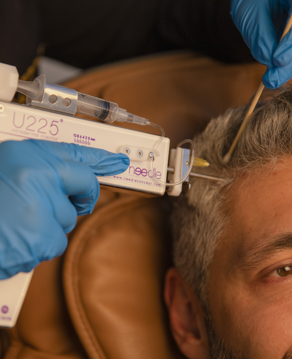 Platelet-rich Plasma