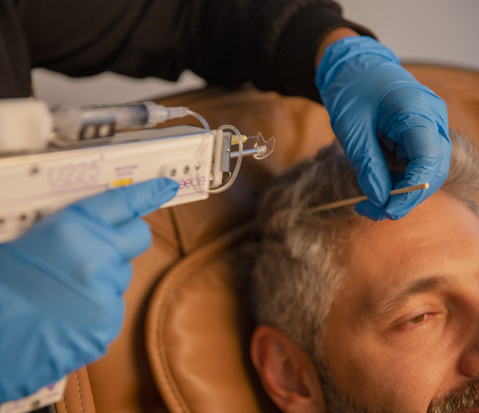 Mesotherapy 3
